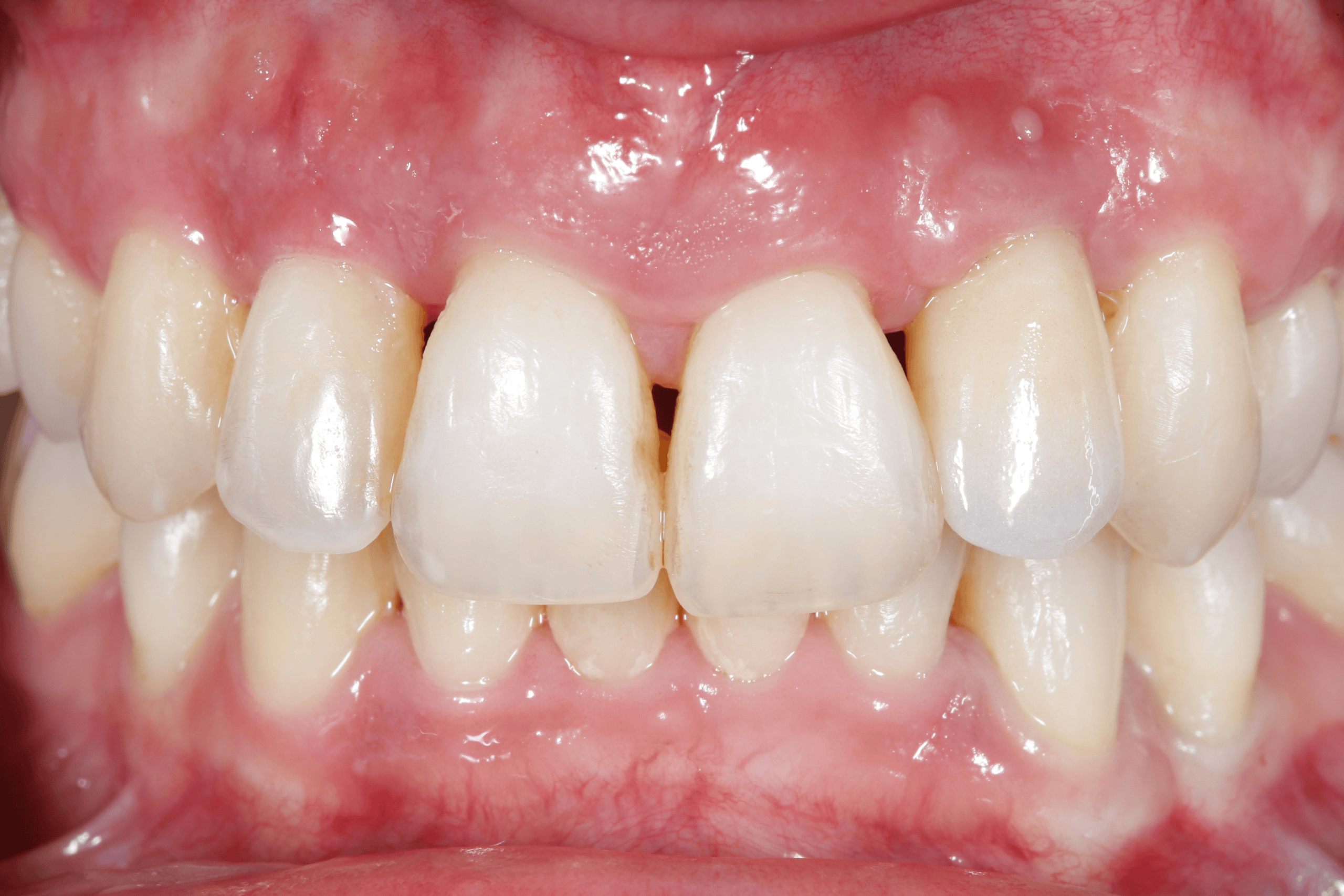 Casos reales de odontología - despues1