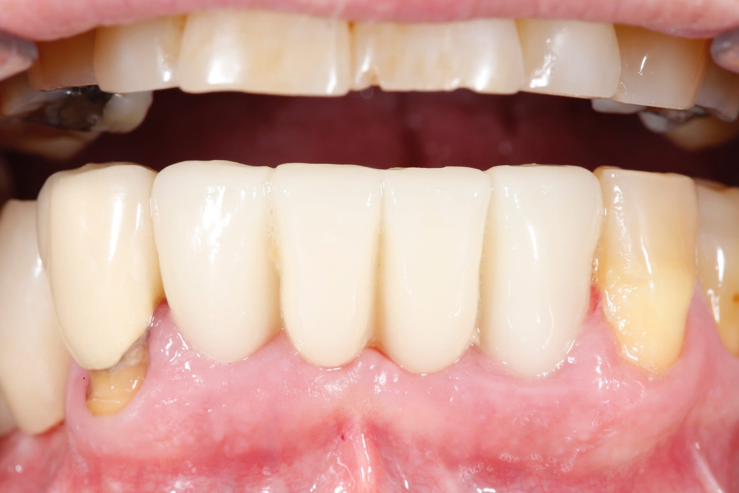 Casos reales de odontología - despues3