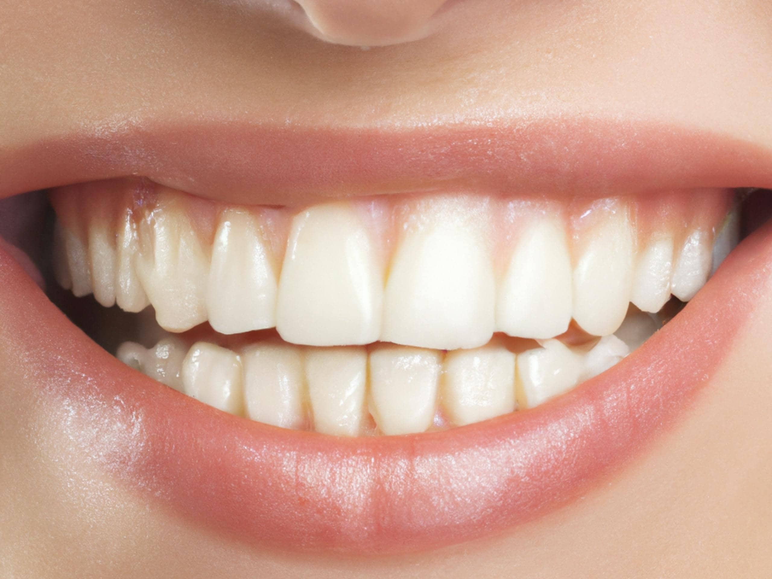 esteticadental